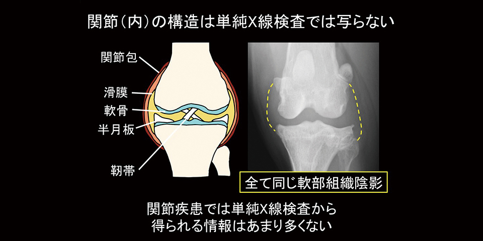 画像が一枚の場合