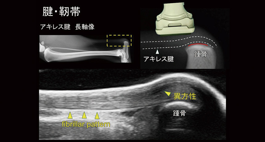 運動器エコー初心者の先生でも、安心して学べます