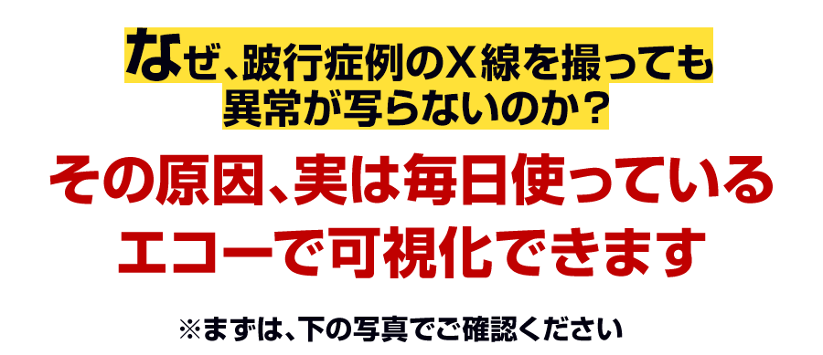 その原因、実は毎日使っている エコーで可視化できます