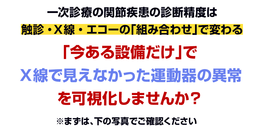 「今ある設備だけ」でＸ線で見えなかった運動器の異常を可視化しませんか？
