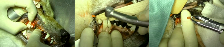 複根歯の抜歯、歯周病症例、破折症例など、フラップ形成、歯冠分割、歯槽骨切削、歯槽骨のトリミング、フラップ縫合が求められる症例も収録