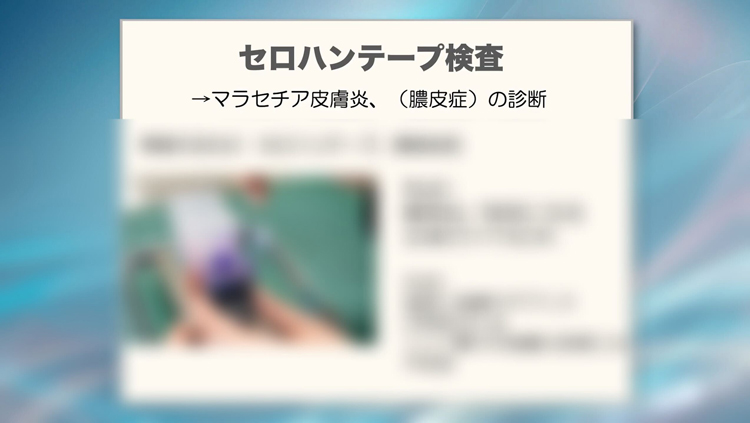セロハンテープ検査