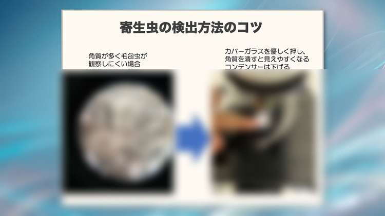 皮膚掻爬検査