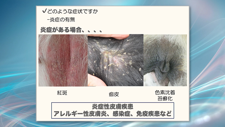 なぜ、たった3秒で疑うべき皮膚疾患と必要な検査を正確に見極められるのか？