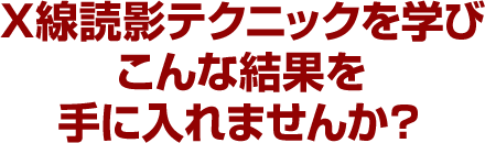 Ｘ線読影テクニックを学びこんな結果を手に入れませんか？