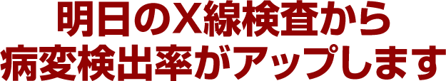 明日のＸ線検査から病変検出率がアップします