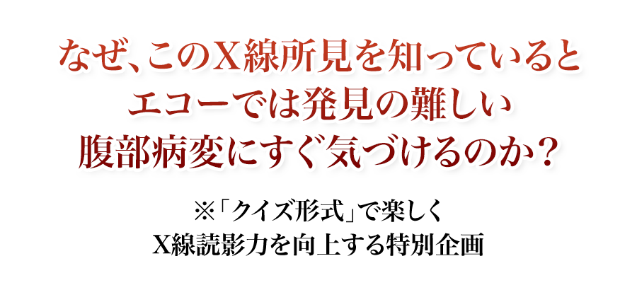 なぜ、このＸ線所見を知っているとエコーでは発見の難しい腹部病変にすぐ気づけるのか？