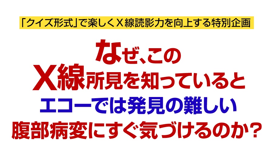 なぜ、このＸ線所見を知っているとエコーでは発見の難しい腹部病変にすぐ気づけるのか？