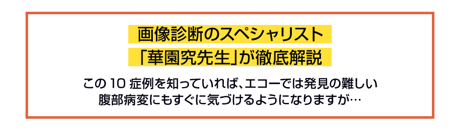 画像診断のスペシャリスト「華園究先生」が徹底解説