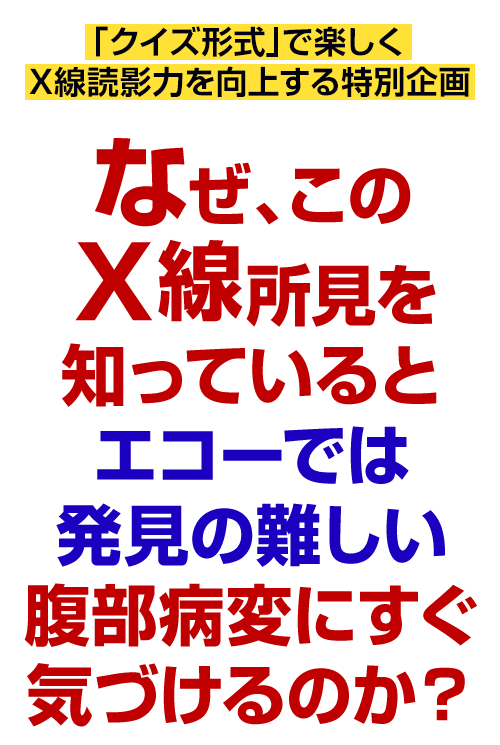 なぜ、このＸ線所見を知っているとエコーでは発見の難しい腹部病変にすぐ気づけるのか？