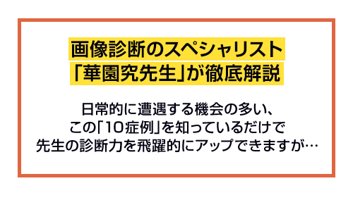 画像診断のスペシャリスト「華園究先生」が徹底解説