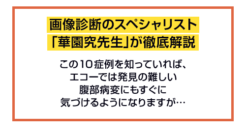 画像診断のスペシャリスト「華園究先生」が徹底解説