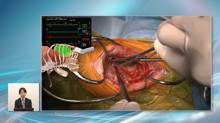 高画質なオペ映像で、細部まで確認できます