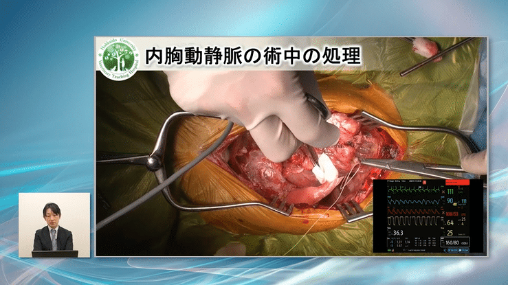 高画質なオペ映像で、細部まで確認できます