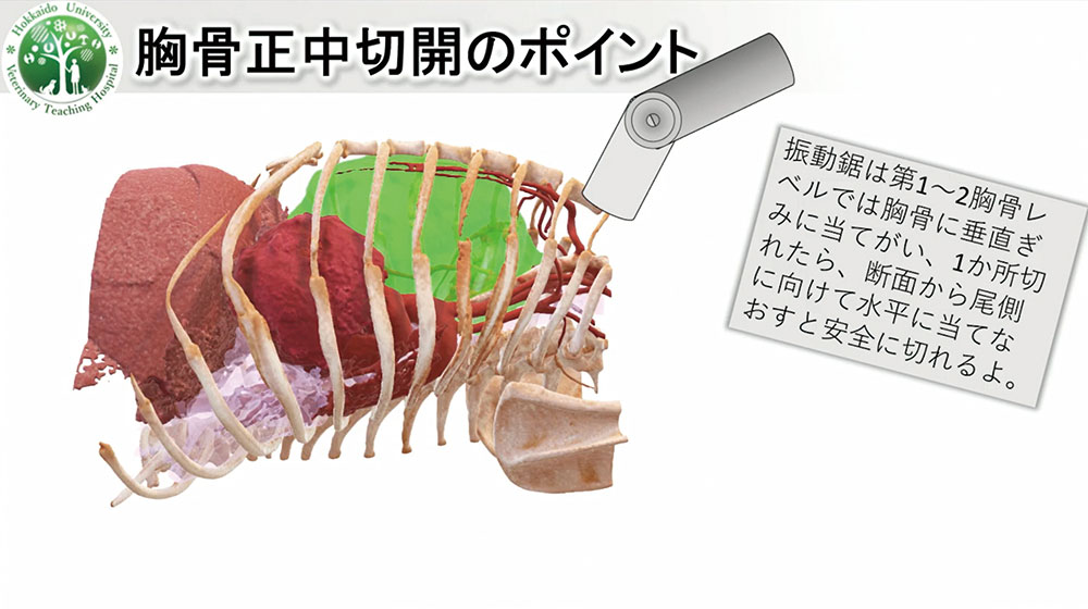 胸骨正中切開の不安とストレスを軽減するテクニックです