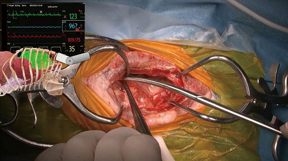 高画質なオペ映像で、細部まで確認できます