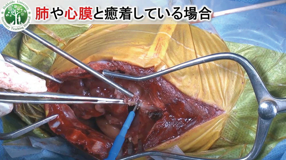 高画質なオペ映像で、細部まで確認できます