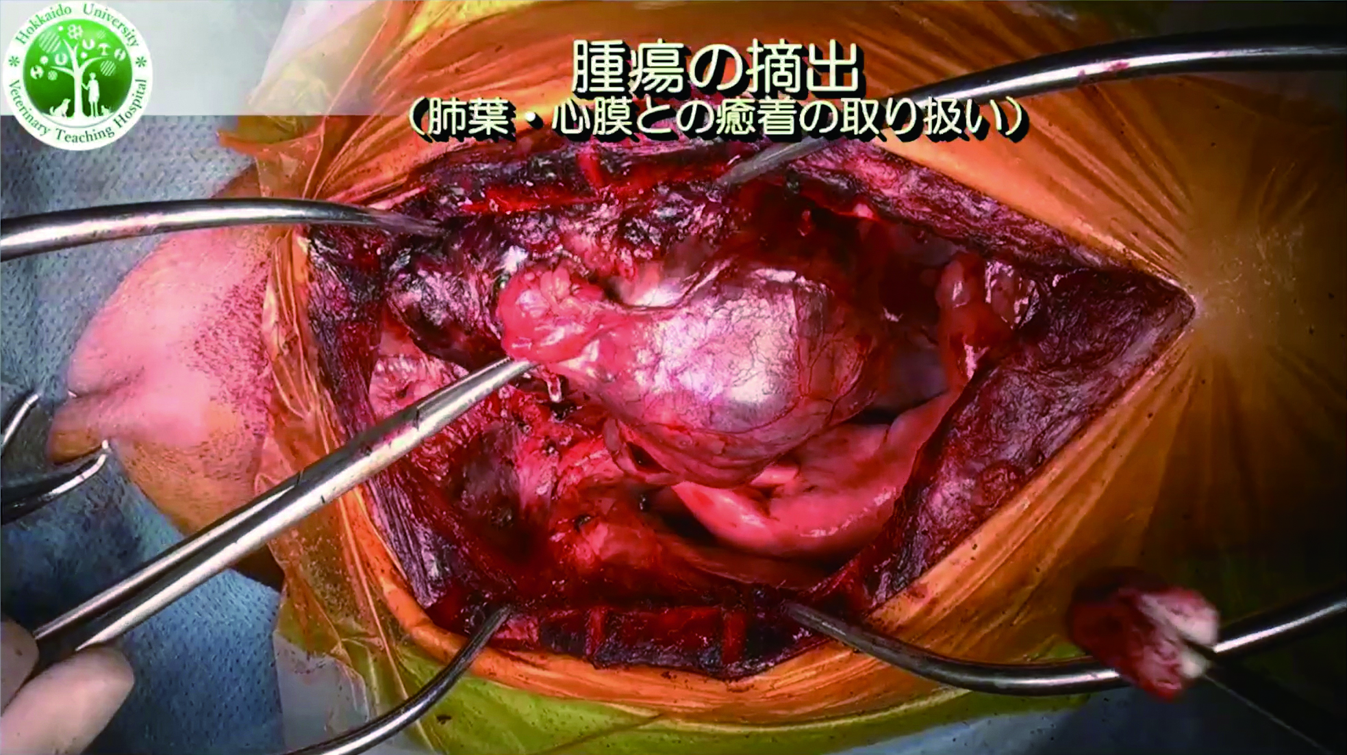 なぜ、心臓頭側の胸腺腫を大出血のリスクを最小化しながら安全に摘出できるのか？