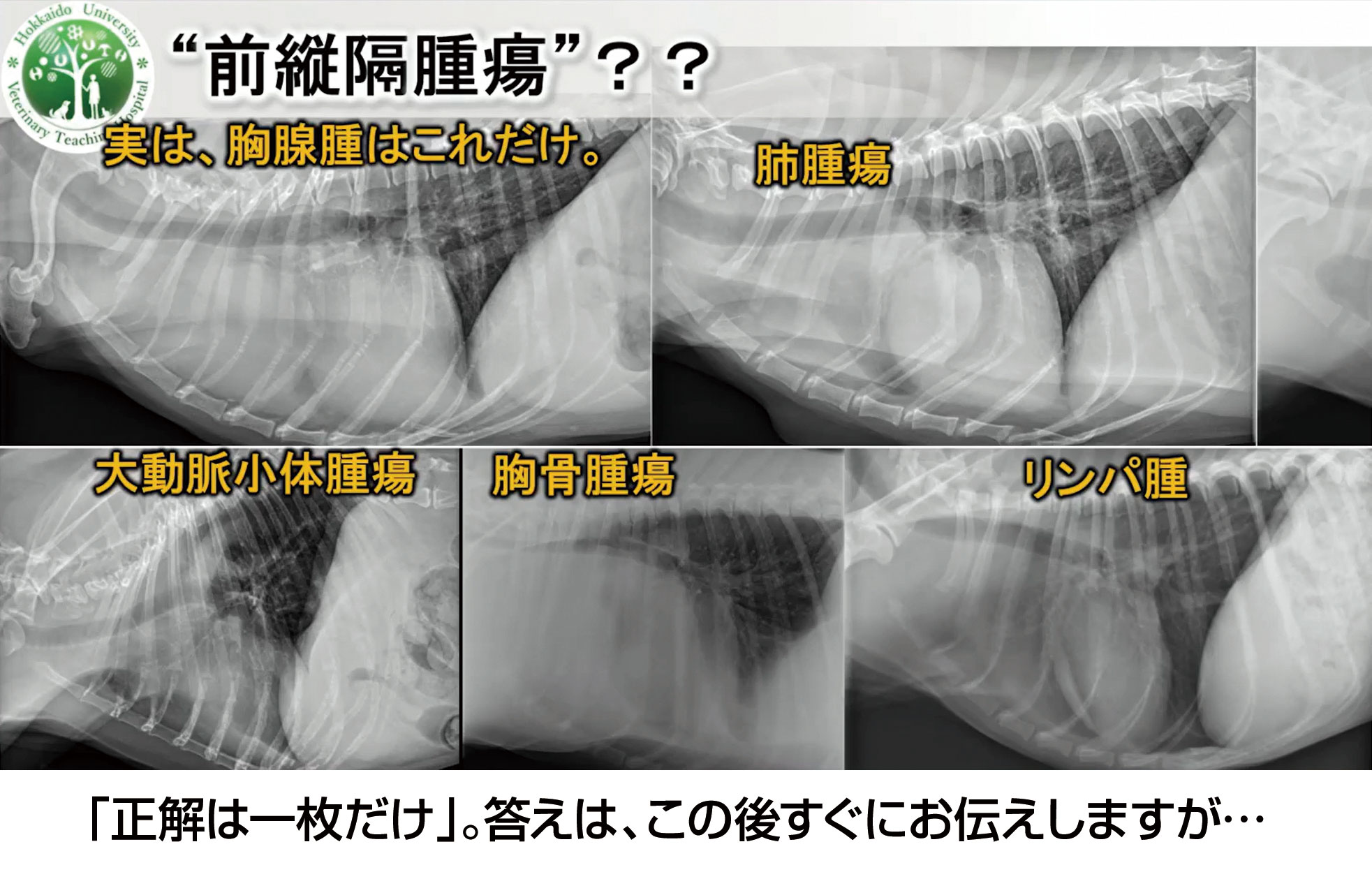 以下の5枚の画像のうち胸腺腫はどれでしょう？