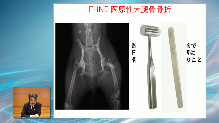 “使用する器具で、手術のクオリティは大きく変わります”