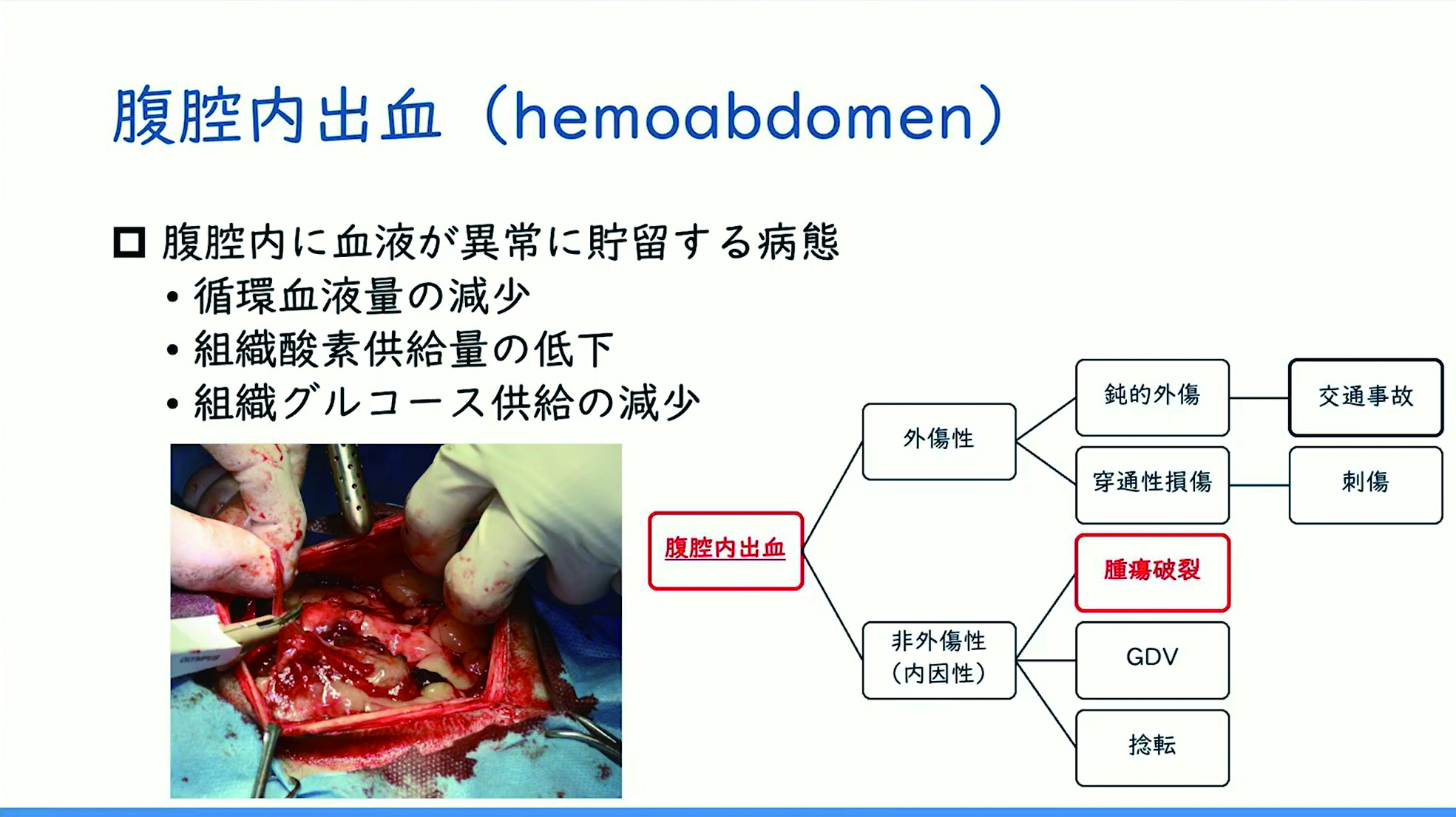 腹腔内出血