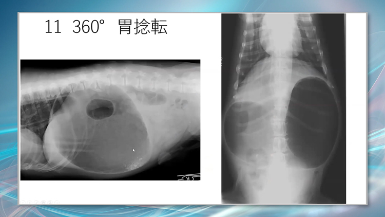 360度捻転しているケースは見逃しやすいので注意が必要です