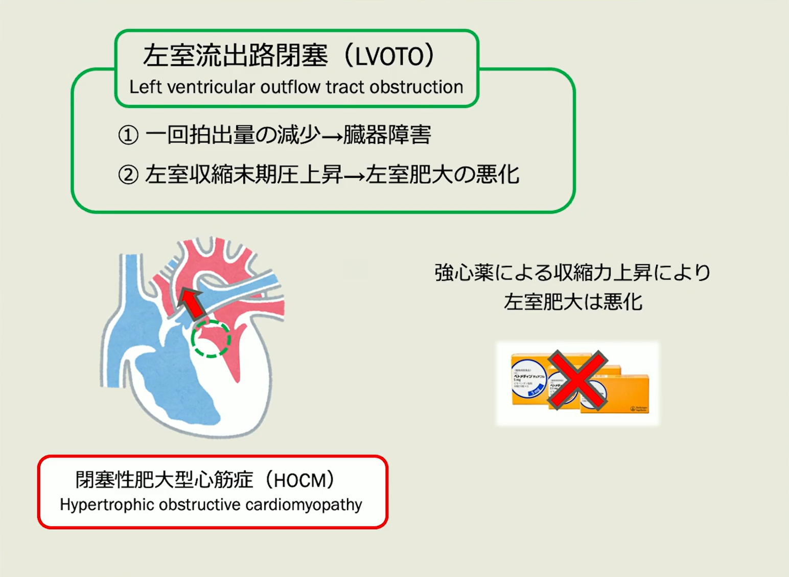 抜歯の術前検査でHCMを発見先生は、急変させない心疾患の麻酔管理ができますか？