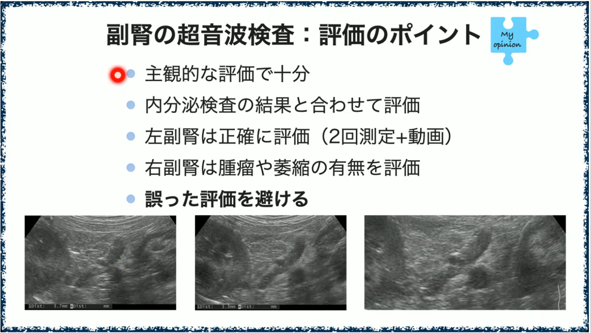 診断率が上がる！副腎・甲状腺疾患の画像検査術 | 株式会社 医療