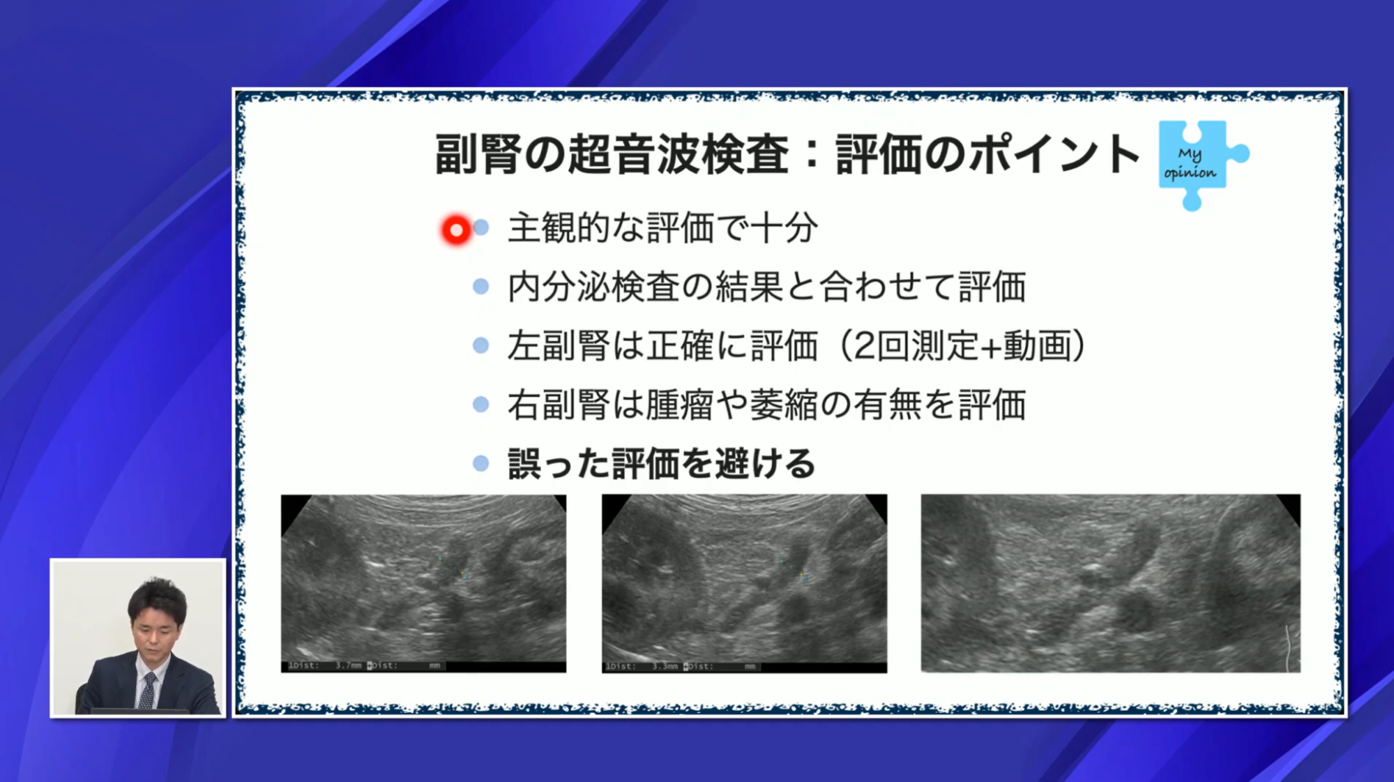 副腎の超音波検査:評価のポイント