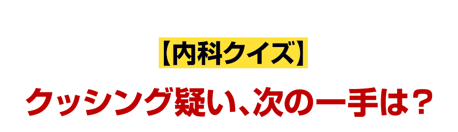 【内科クイズ】クッシング疑い、次の一手は？