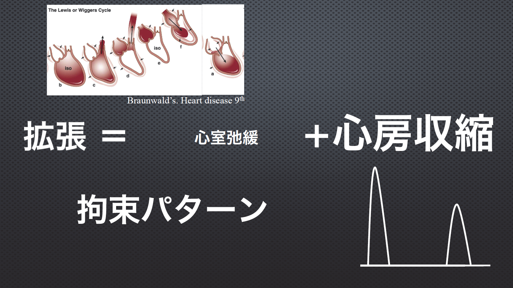 高速パターン