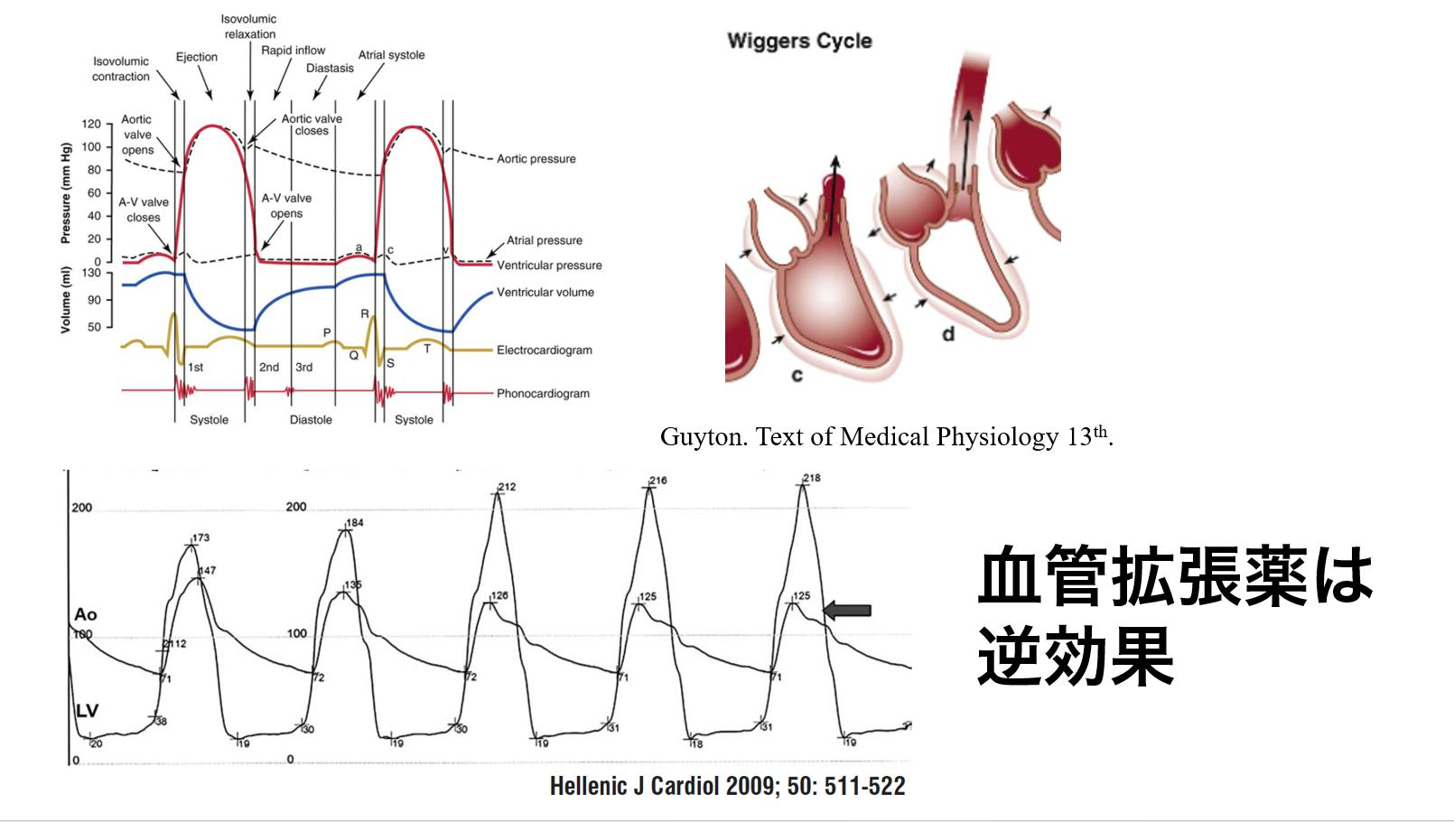 血管拡張薬は逆効果
