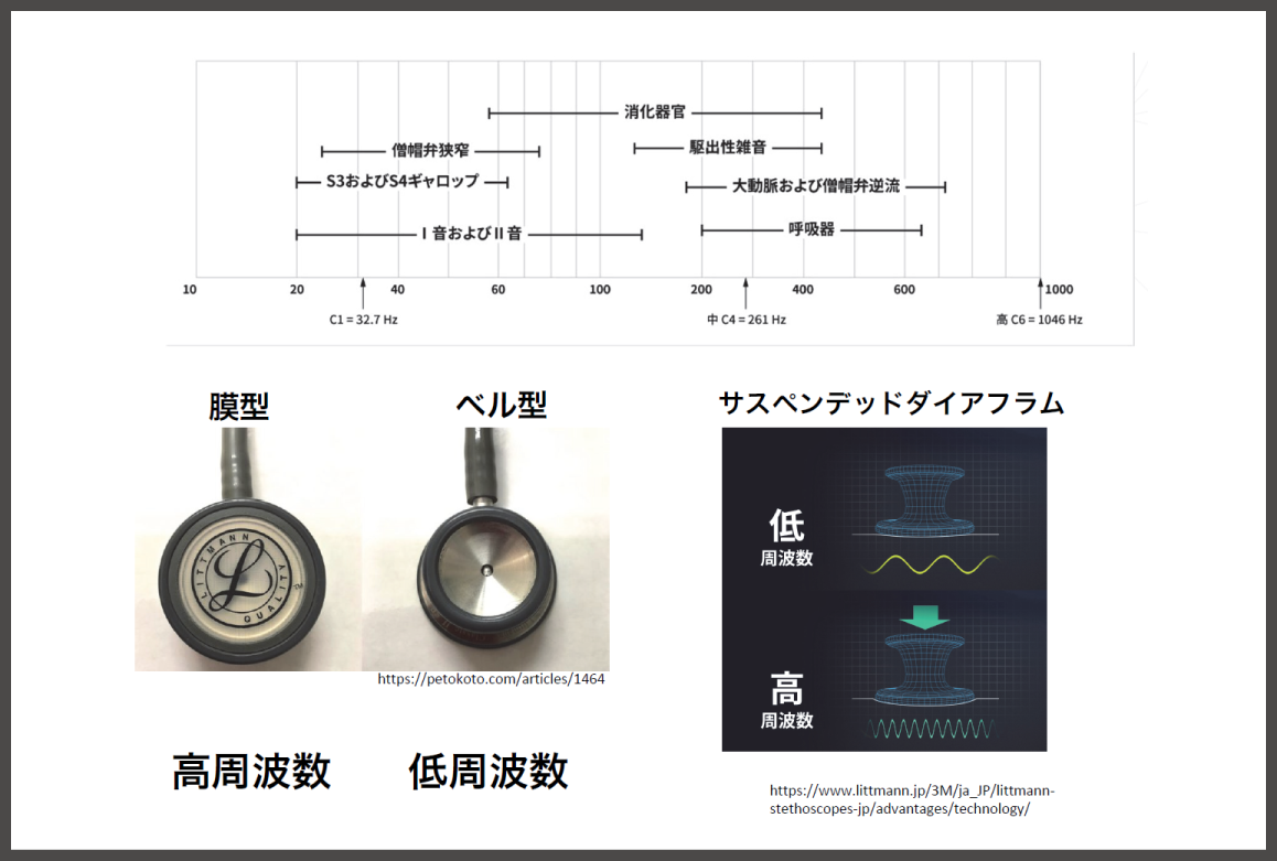 HCMの見逃しを減らす「思考プロセス」