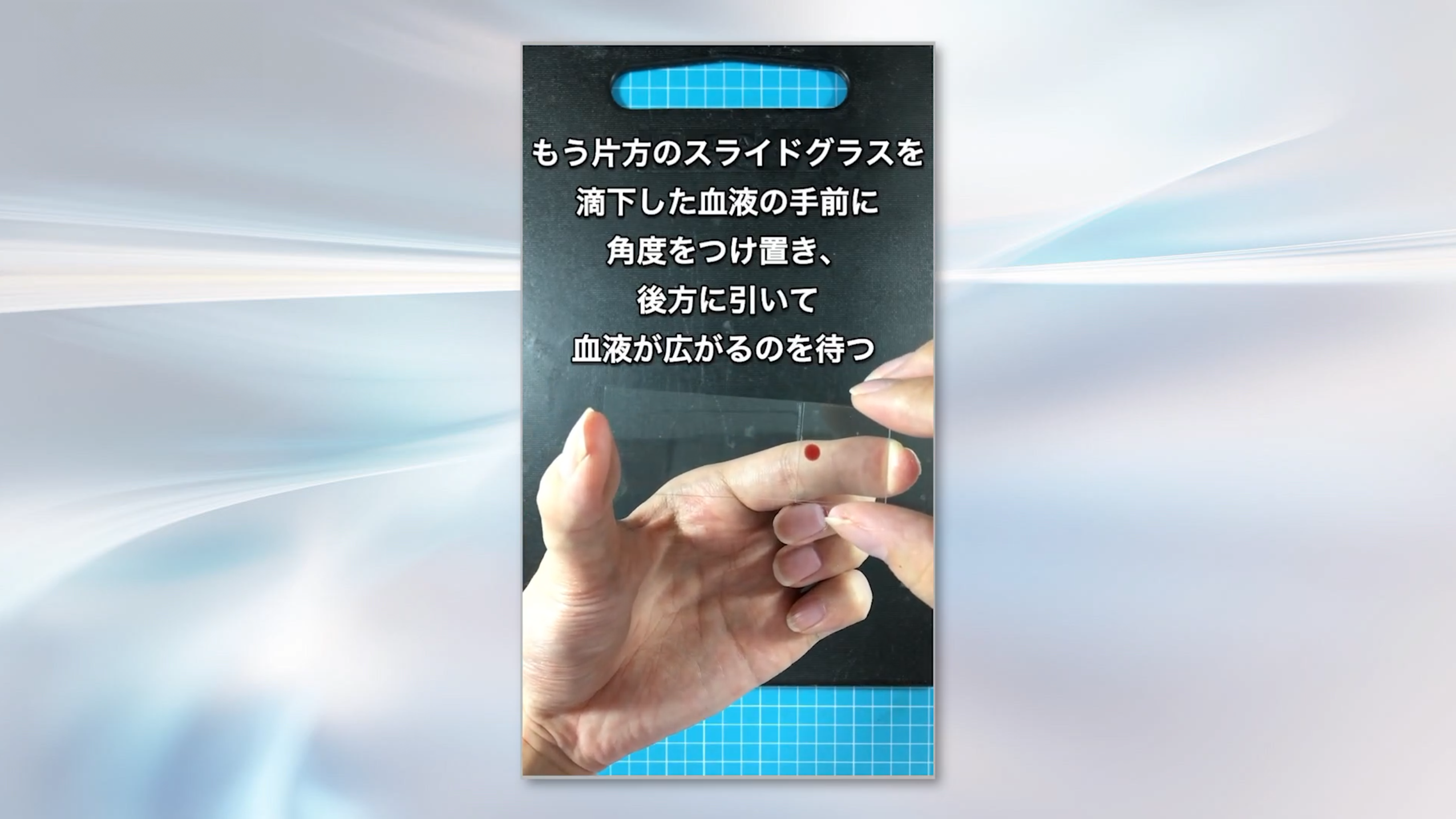 採血時の注意すべき検査への影響