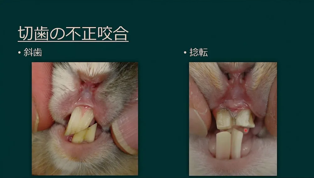 「赤い尿」は、まず血尿かどうかの確認が重要です