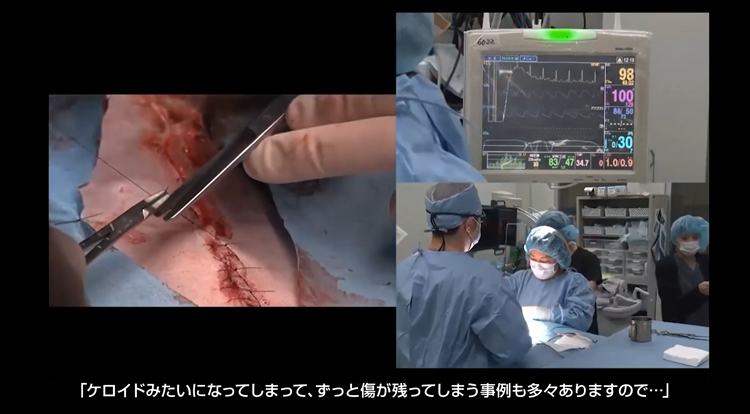 “外科を執刀された湯貫 敏先生に外科手技のポイントを解説していただきました”