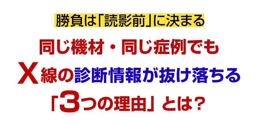 勝負は「読影前」に決まる 同じ機材・同じ症例でも Ｘ線の診断情報が抜け落ちる「3つの理由」とは？
