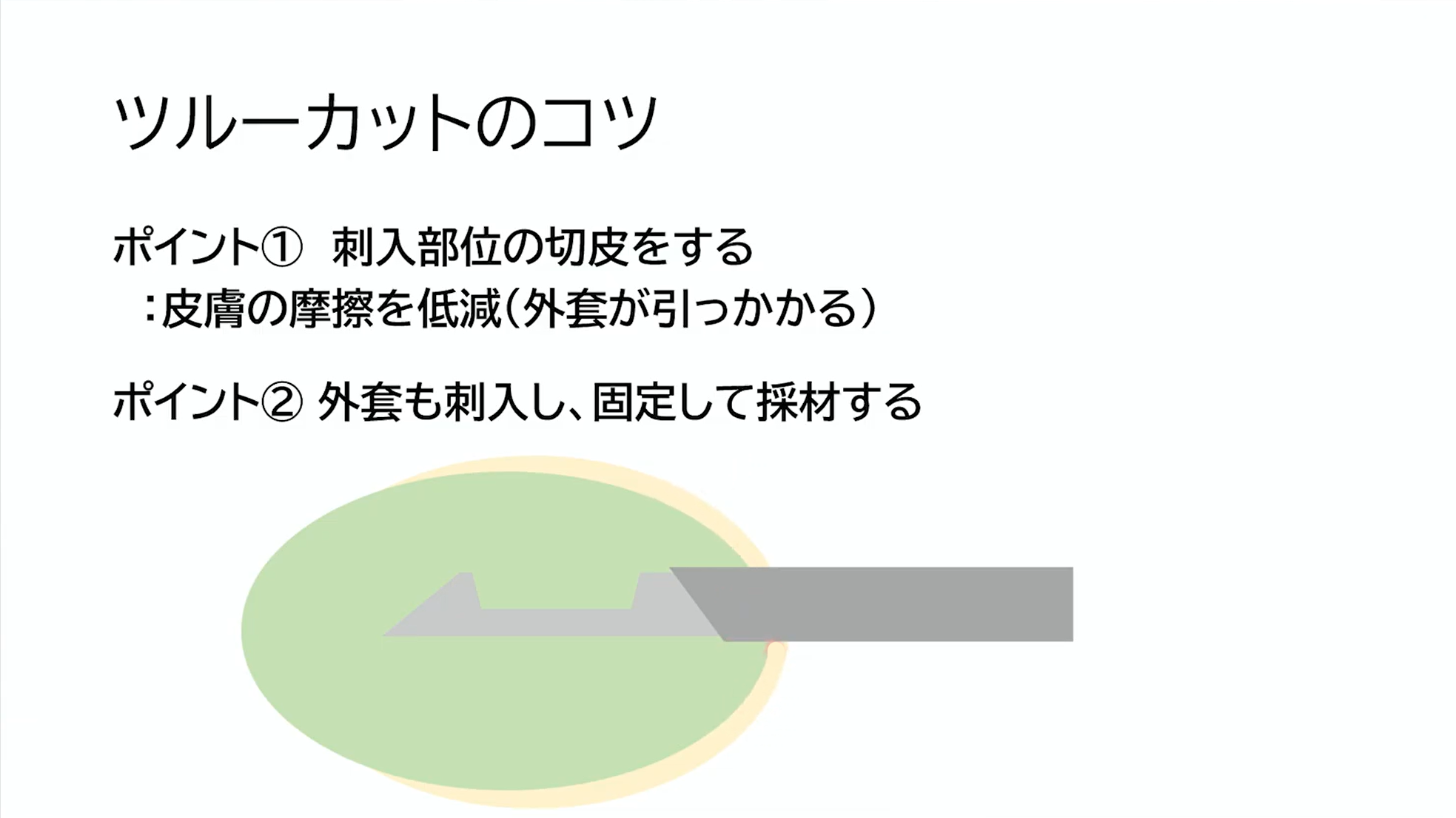 ツルーカット