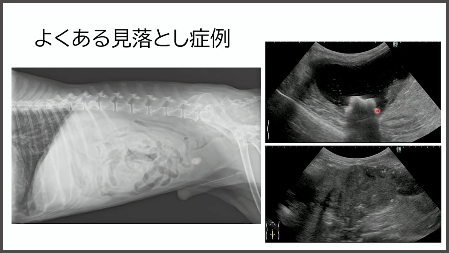“よくある見落とし症例”
