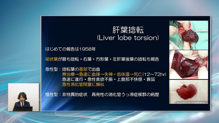消化器の外科手術