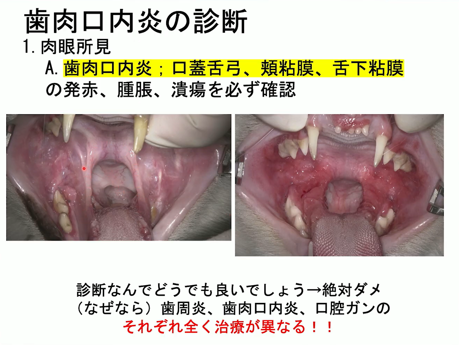 歯肉口内炎の診断