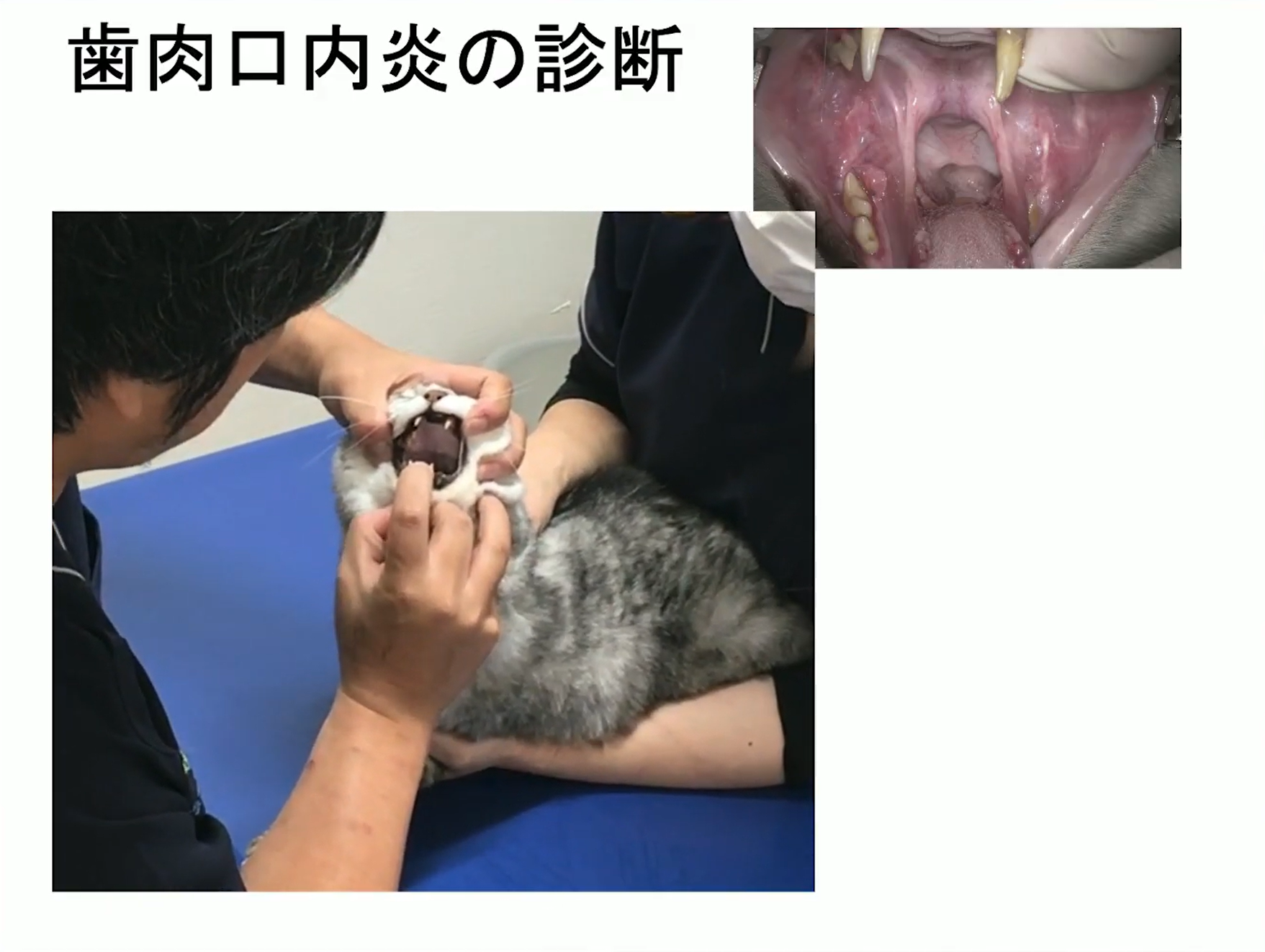 歯肉口内炎の診断