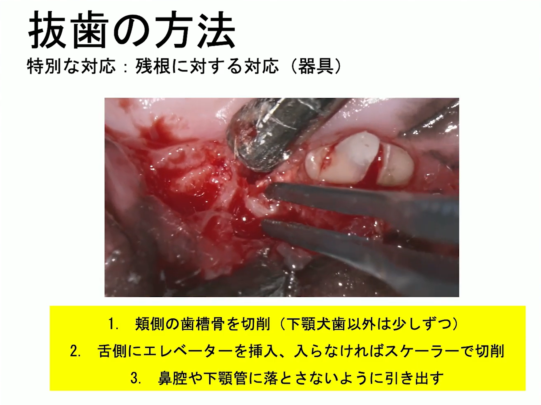 テキスト