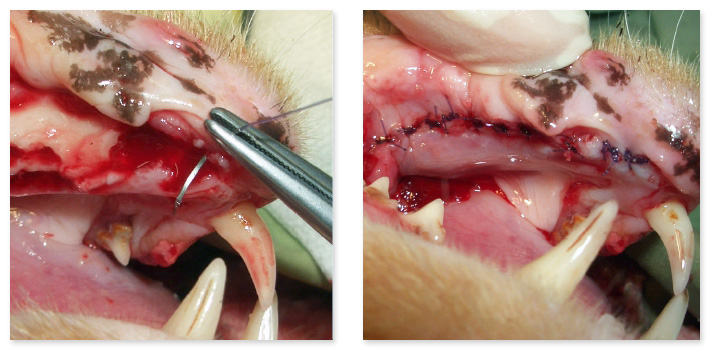 抜歯窩の縫合方法を詳しく解説