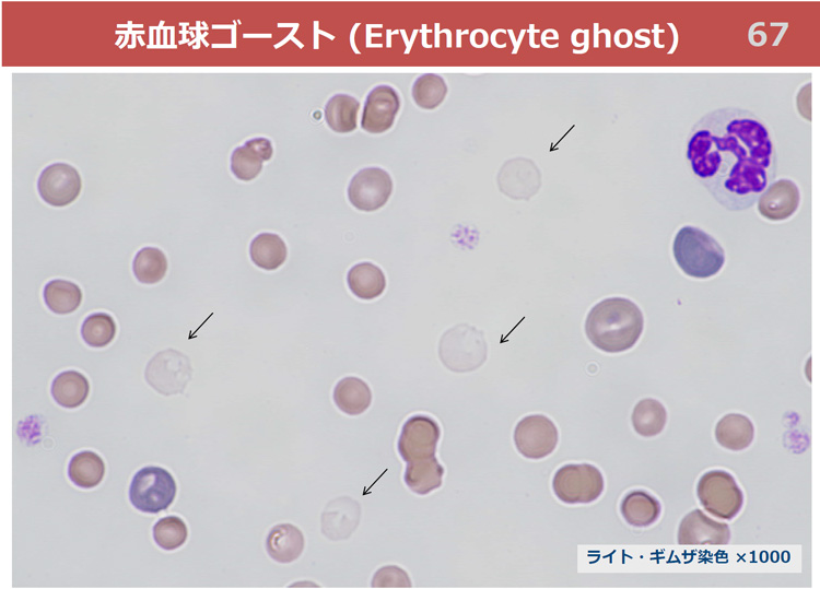 赤血球ゴースト(Erythrocyte ghost)