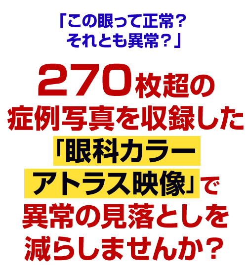 270枚超の症例写真を収録した「眼科カラーアトラスDVD」で異常の見落としを減らしませんか？